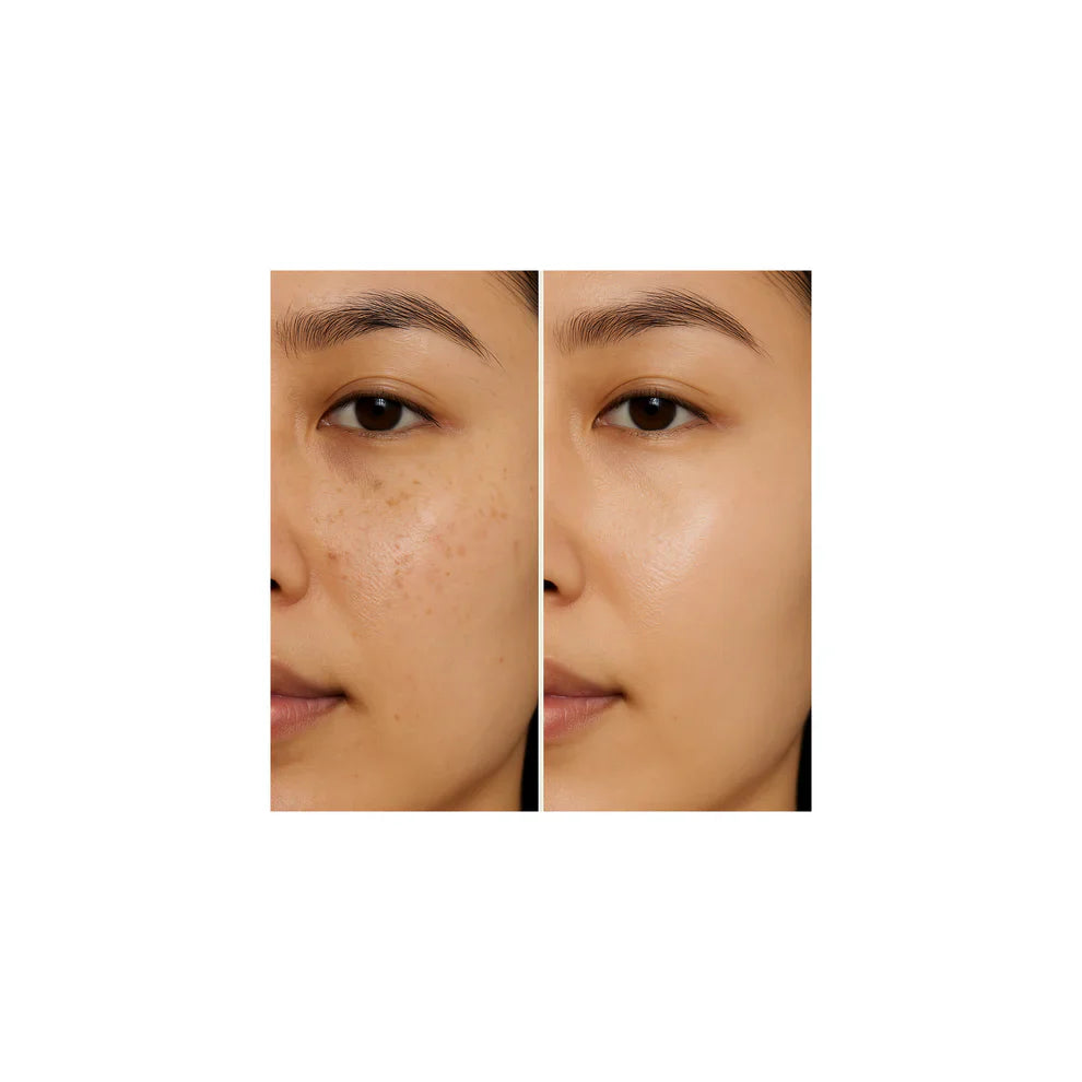 Dark Spot Correcting Glow Serum